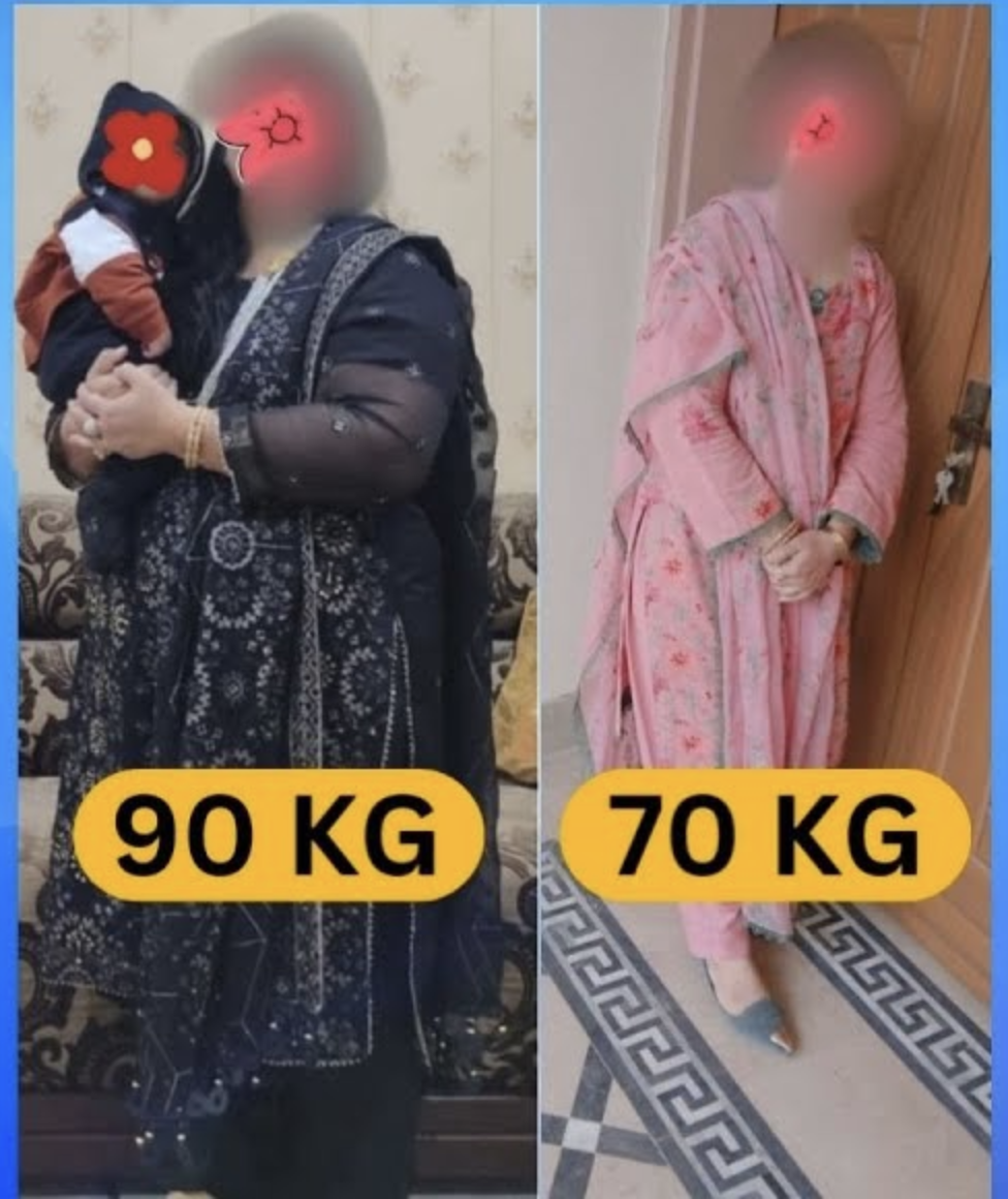 Transformation Journey - -25 KG Lost